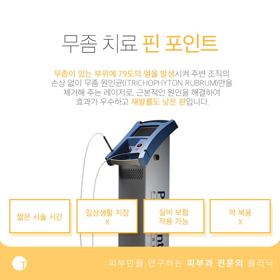 역삼동발톱무좀 미루지말고 해결해요 관련 이미지 4