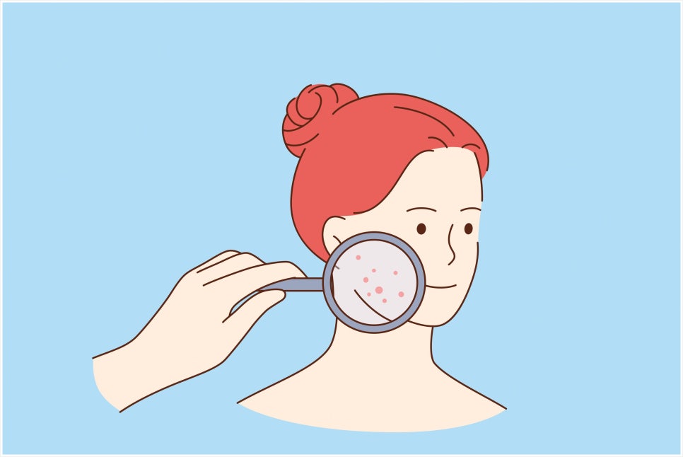 What Are the Effects of Neuramis Skin Enhancer, and How Is It Different from Other Skin Boosters? image 5