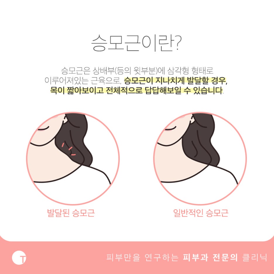 역삼역승모근보톡스 본연의 기능을 고려하여 관련 이미지 2