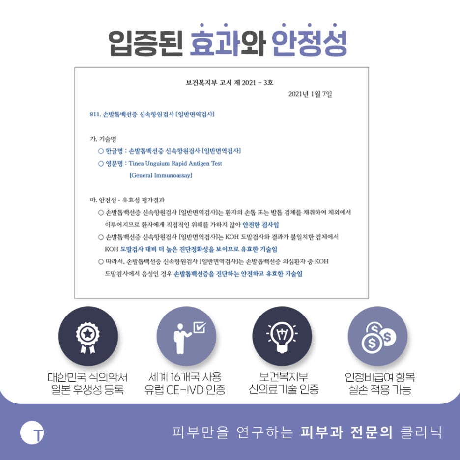 손발톱무좀 신속면역검사 빠르고 정확하게 관련 이미지 5