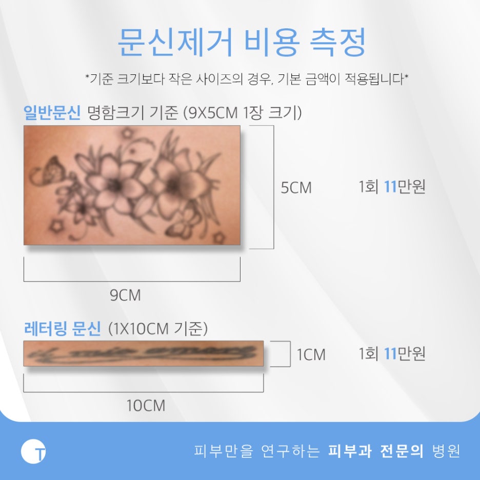 역삼동문신제거 피부손상은 줄이고 효과는 높이고 관련 이미지 8