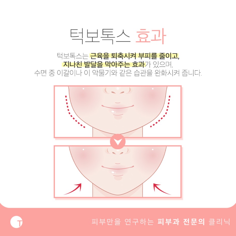 역삼보톡스 개인에게 커스터마이징하여 관련 이미지 2