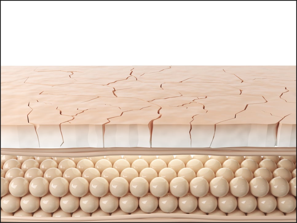 Yeoksam Station Skinvive: Is It Suitable for Dry, Rough Skin? image 3
