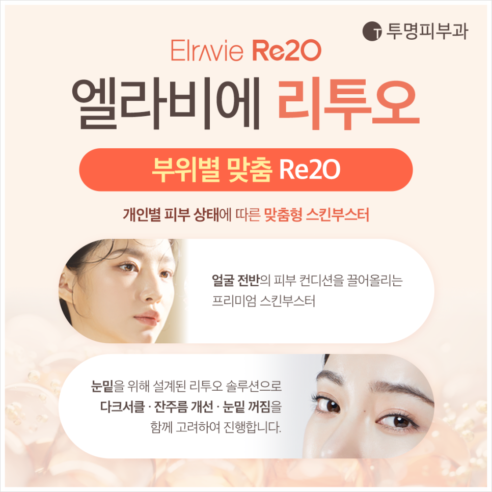 역삼아이리투오, 다크서클 개선과 눈 밑 꺼짐으로 고민이다면 관련 이미지 4