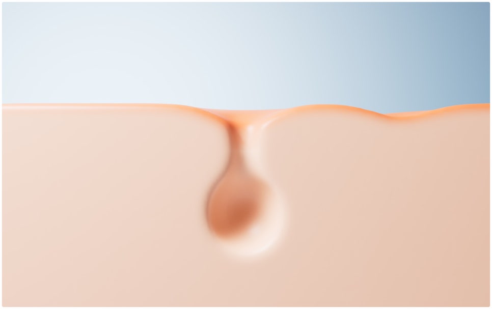 To a Clear Skin Clinic That Uses Only High-End Products in Gangnam Ellevie Rituo! image 2