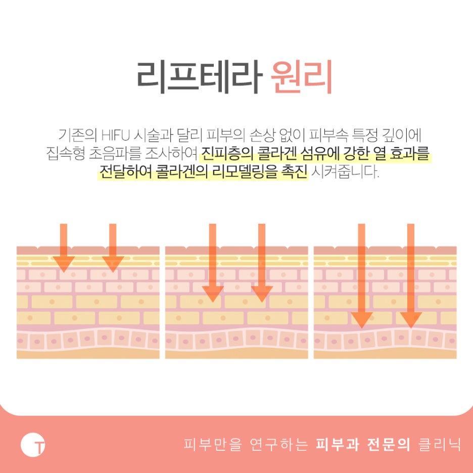 역삼역피부과추천 리프테라로 빈틈없이 관련 이미지 3