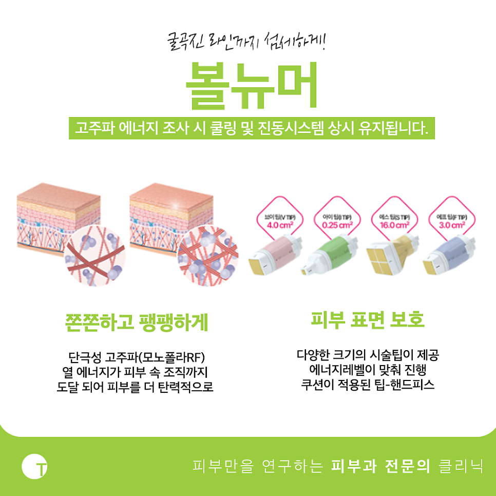 볼뉴머 키닥터 방문후에 후기가 좋은 이유는 관련 이미지 2