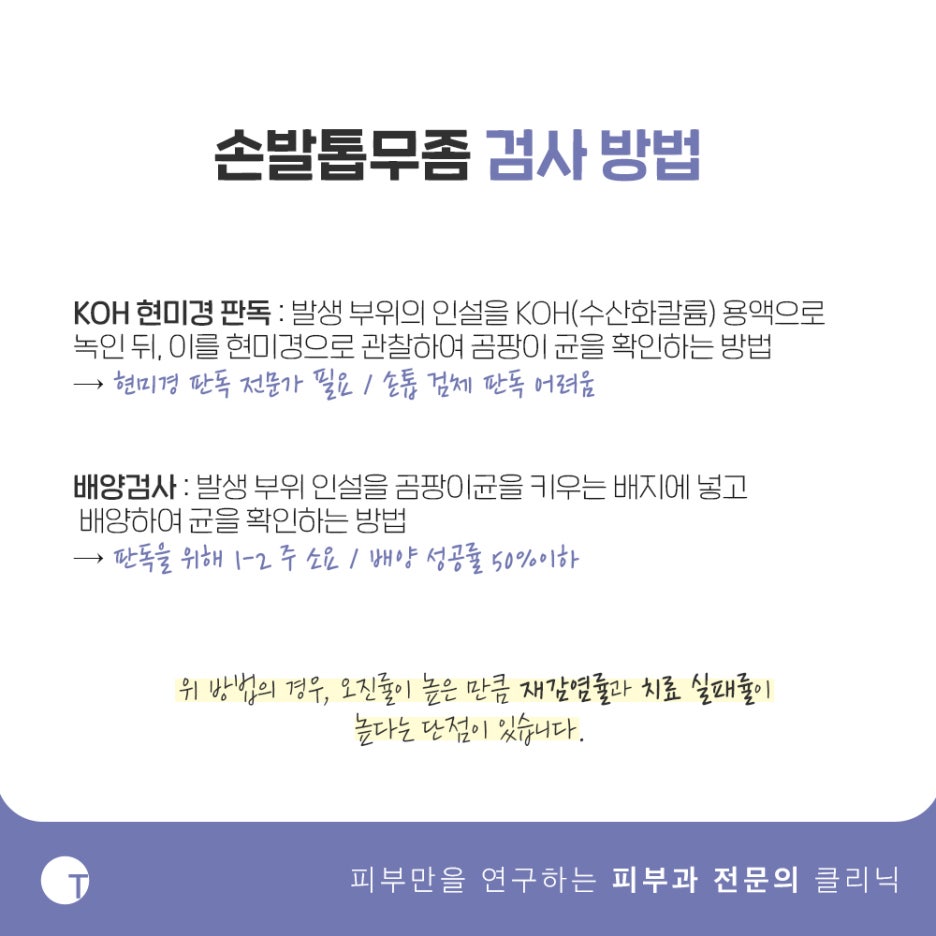 손발톱무좀 신속면역검사 빠르고 정확하게 관련 이미지 3