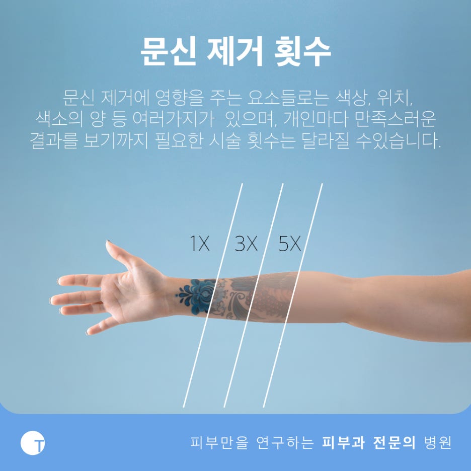 역삼동문신제거 피부손상은 줄이고 효과는 높이고 관련 이미지 9