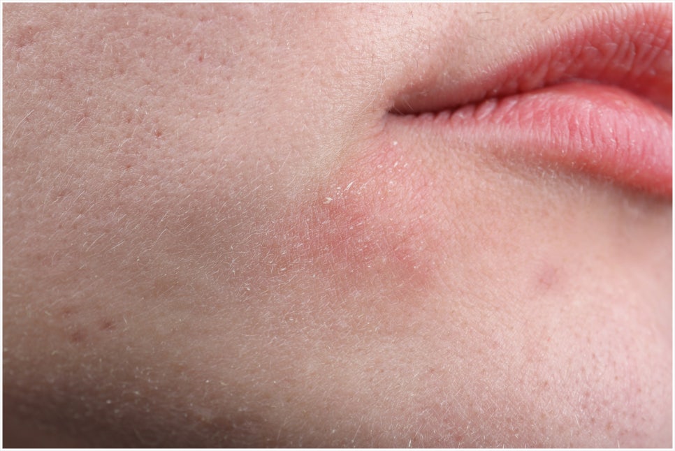 For Outstanding ReVive Skin Booster Care Near Yeoksam Station, Transparent Dermatology Clinic image 1