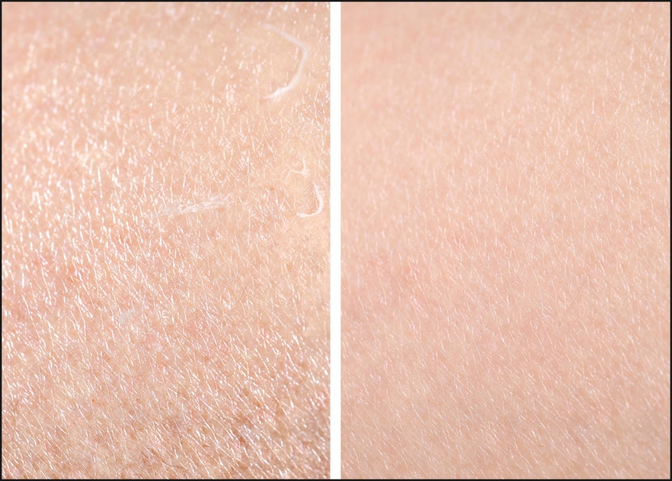 Yeoksam Station Skinvive: Is It Suitable for Dry, Rough Skin? image 1