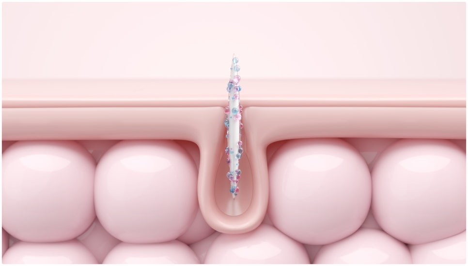To a Clear Skin Clinic That Uses Only High-End Products in Gangnam Ellevie Rituo! image 3