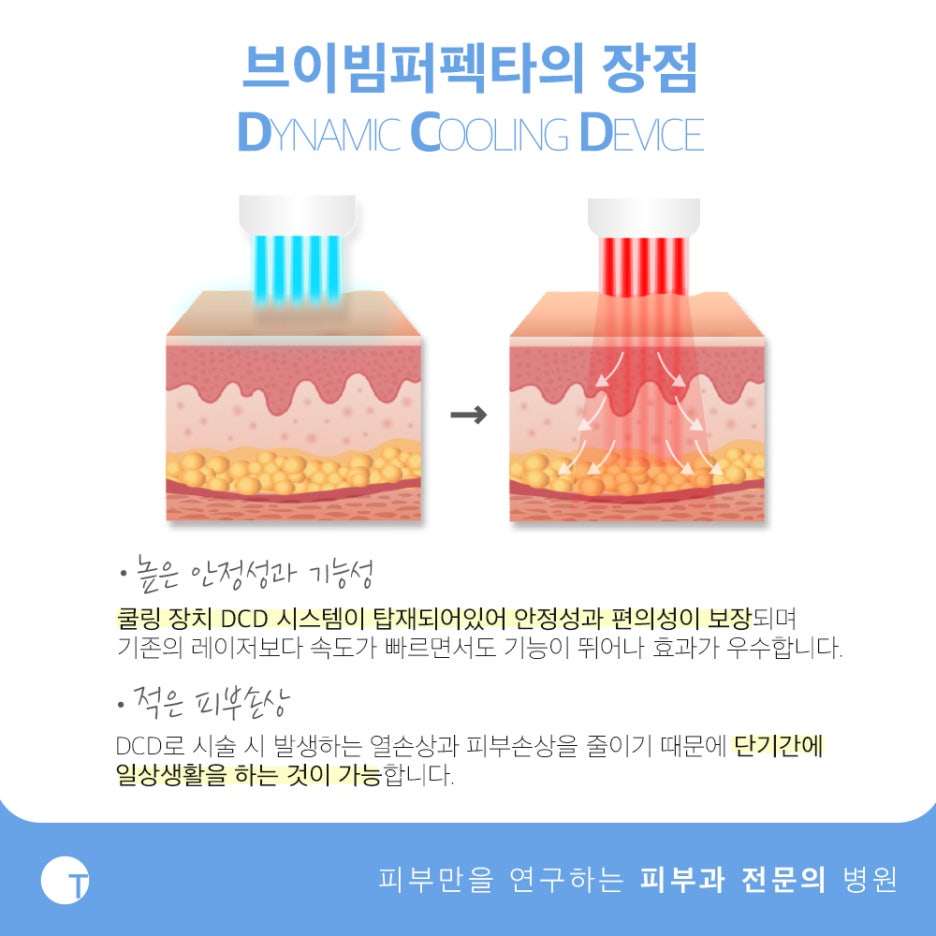 역삼역안면홍조 브이빔퍼펙타로 해결해요 관련 이미지 3