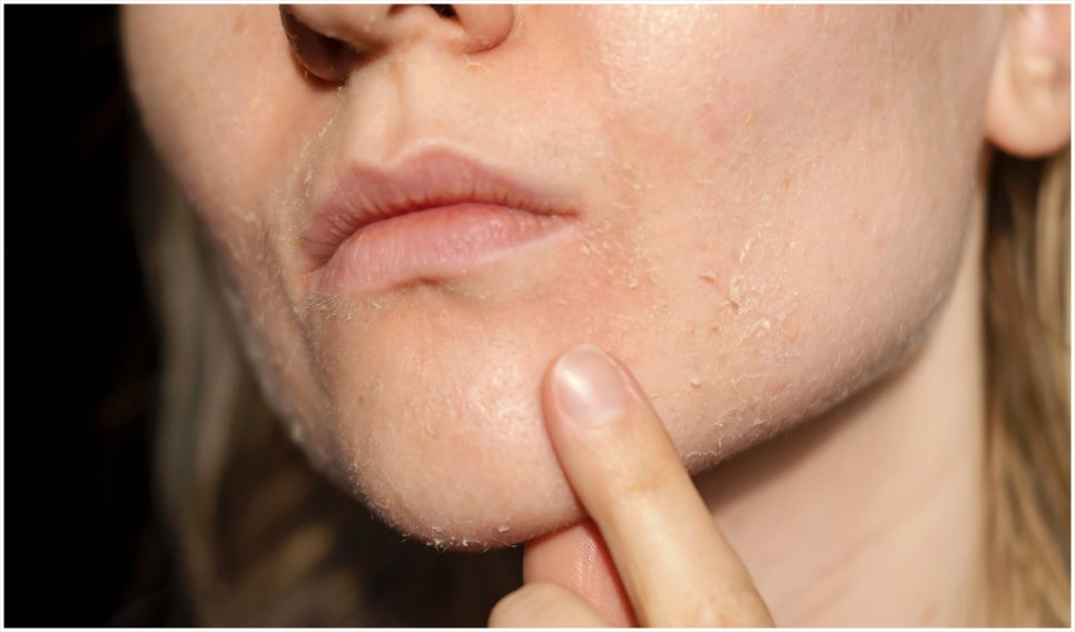 Yeoksam-dong Rejuran Skin Booster at Transparent Dermatology image 1