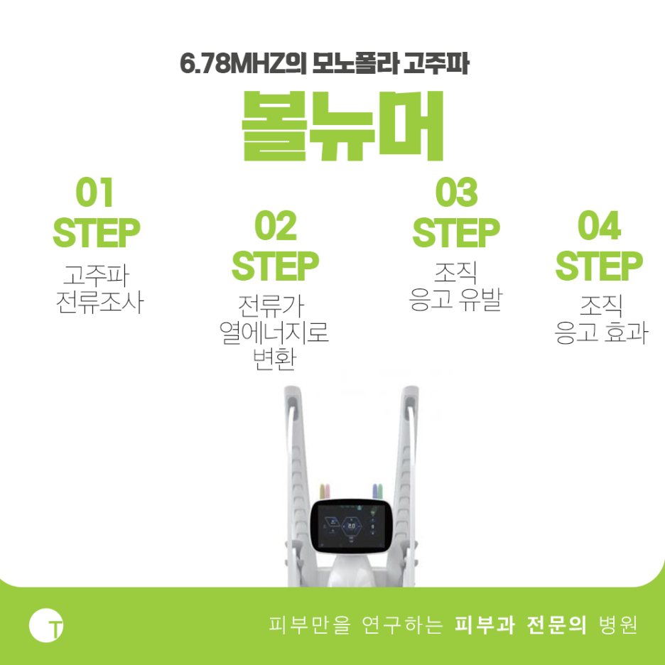 역삼역볼뉴머 기능 좋은 새장비로 관련 이미지 2