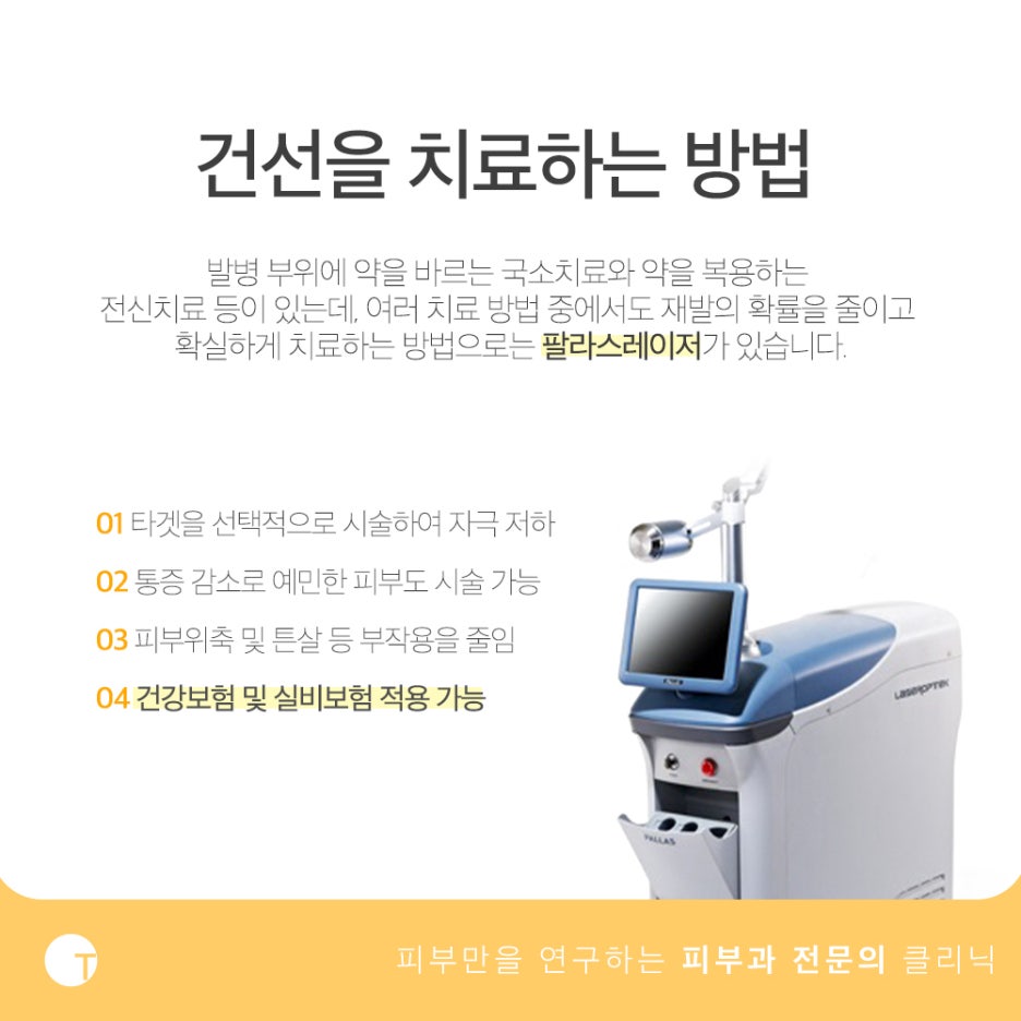 건선 팔라스레이저 보험적용이 가능해요 관련 이미지 4