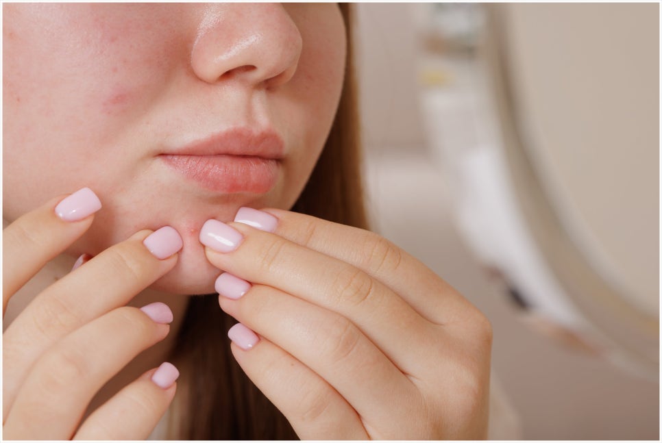 Yeoksam-dong Rejuran Skin Booster at Transparent Dermatology image 3