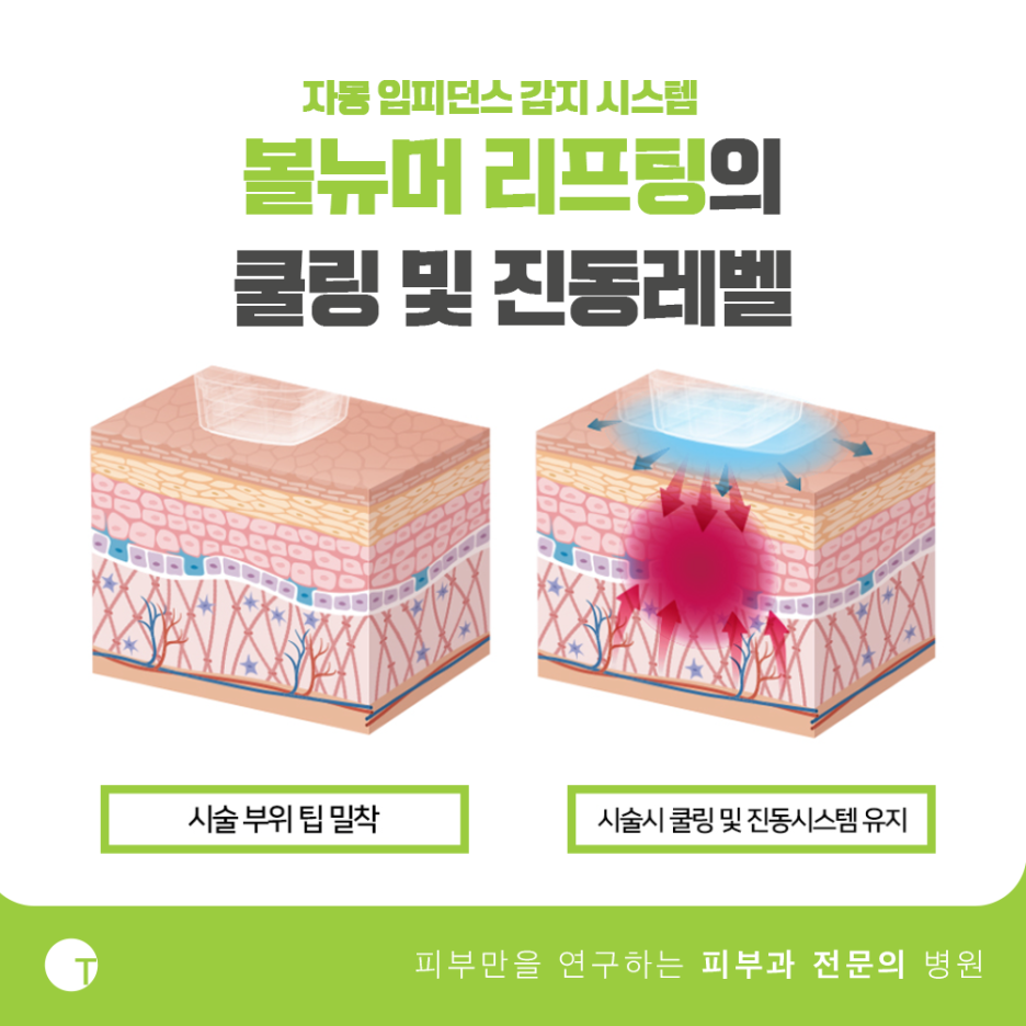 역삼역볼뉴머 기능 좋은 새장비로 관련 이미지 4