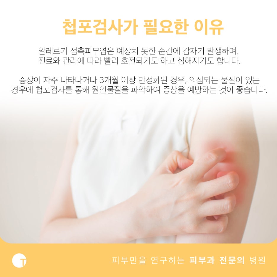 알레르기 첩포검사 의심물질을 확인해요 관련 이미지 4