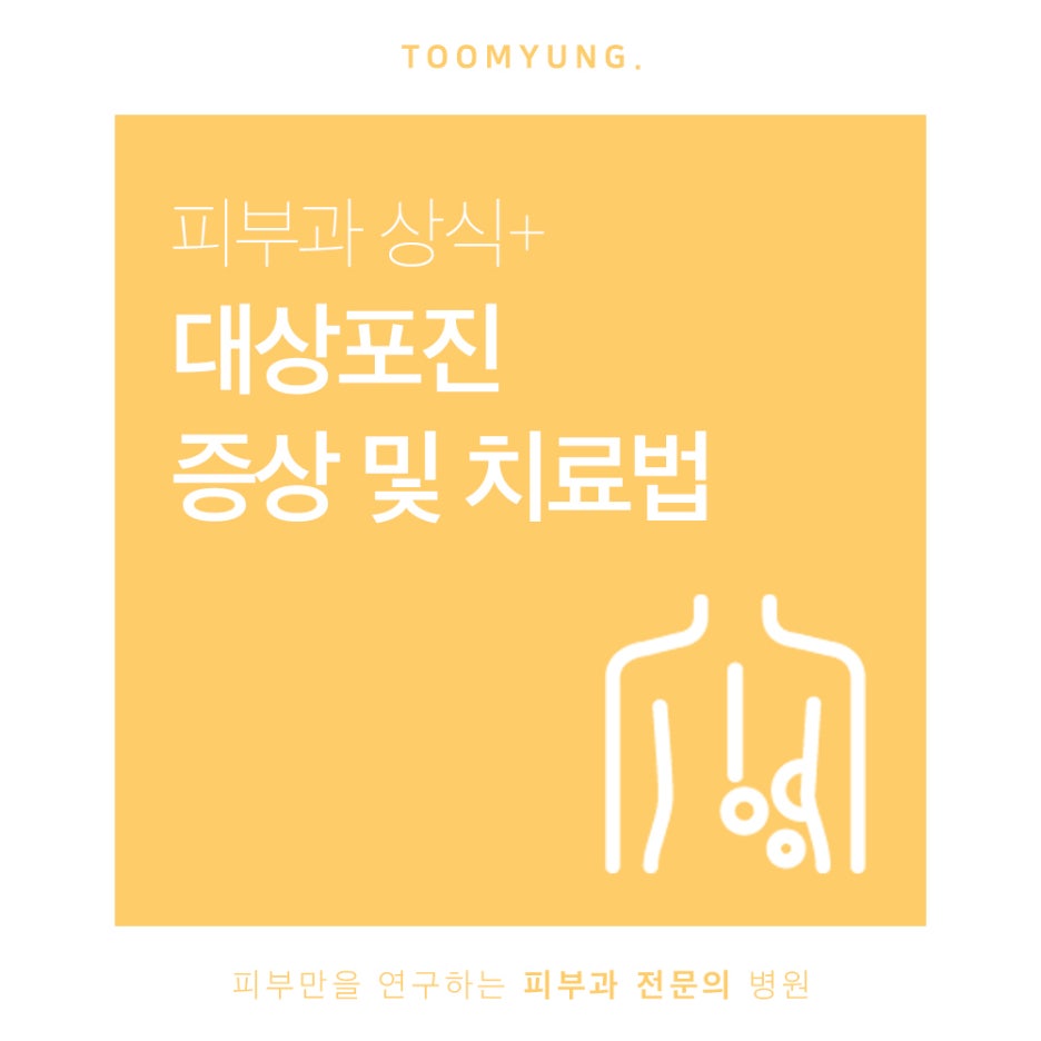 대상포진 증상과 치료방법 알아봐요 관련 이미지 1