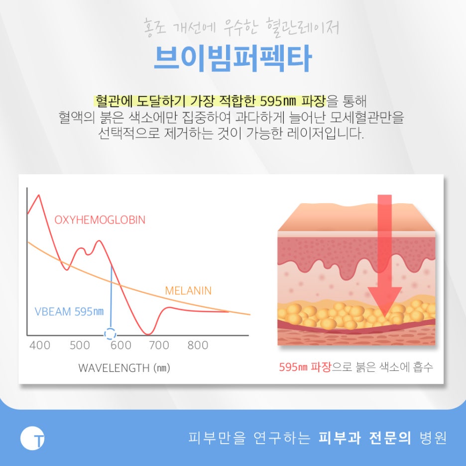 역삼역안면홍조 브이빔퍼펙타로 해결해요 관련 이미지 2