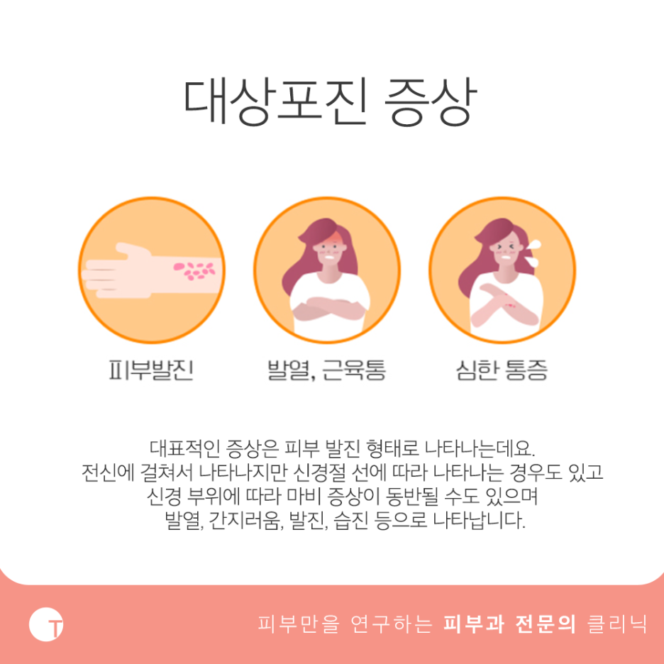 역삼동싱그릭스 대상포진을 예방해요! 관련 이미지 2