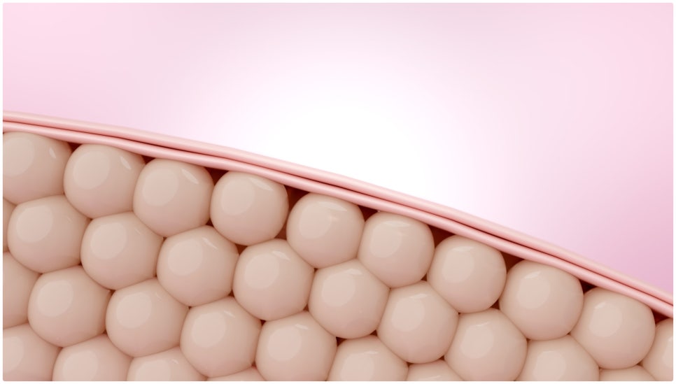 If You’re Stressed by Acne Scars, Yeoksam Gold PTT image 3