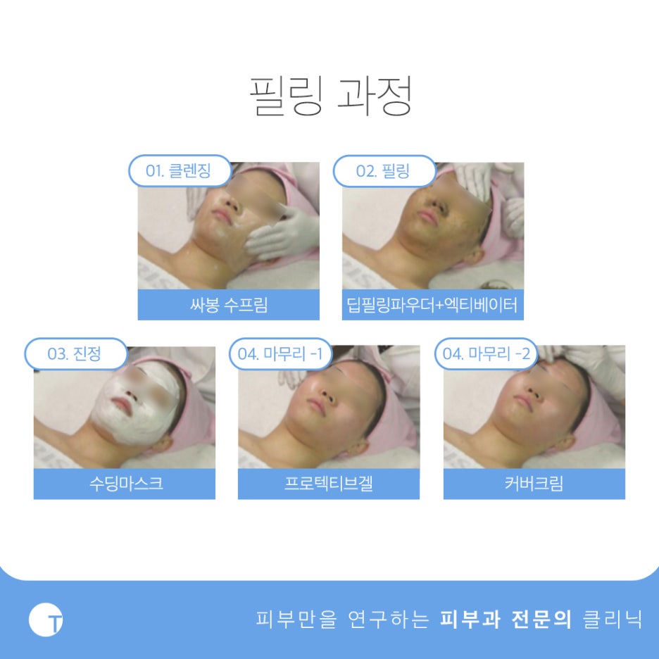 역삼역여드름 저자극필링으로 깨끗하게 관련 이미지 3