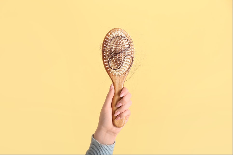 역삼역탈모보톡스 더는 스트레스받지 말고 관련 이미지 2