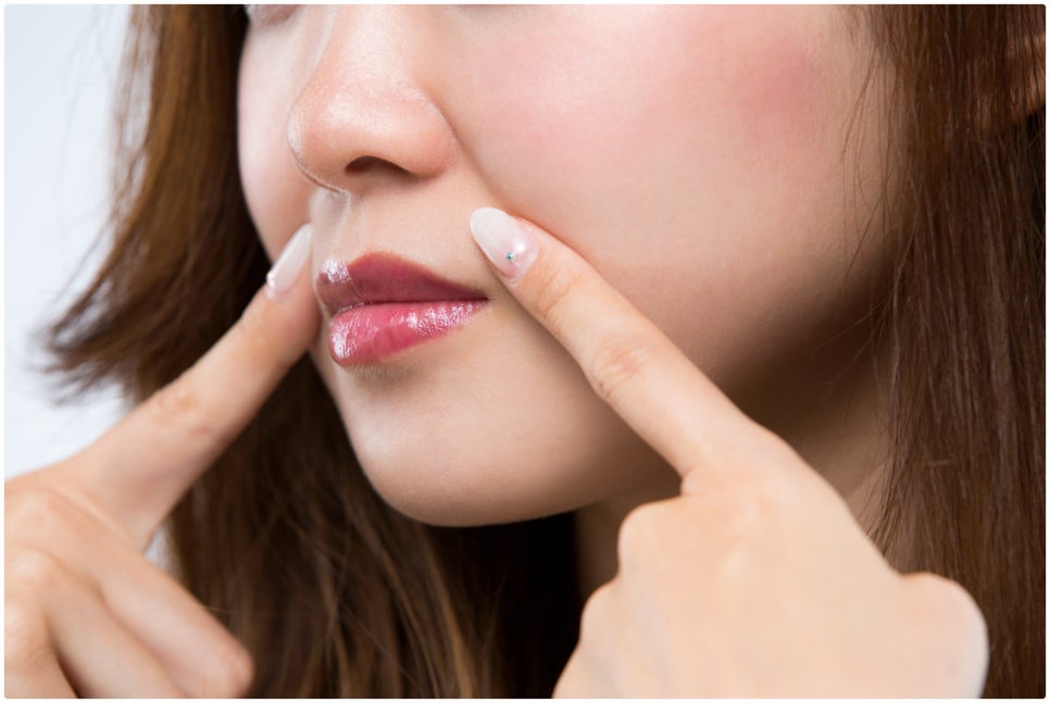 How to Improve Sagging Skin with Yeoksam Liftera image 1