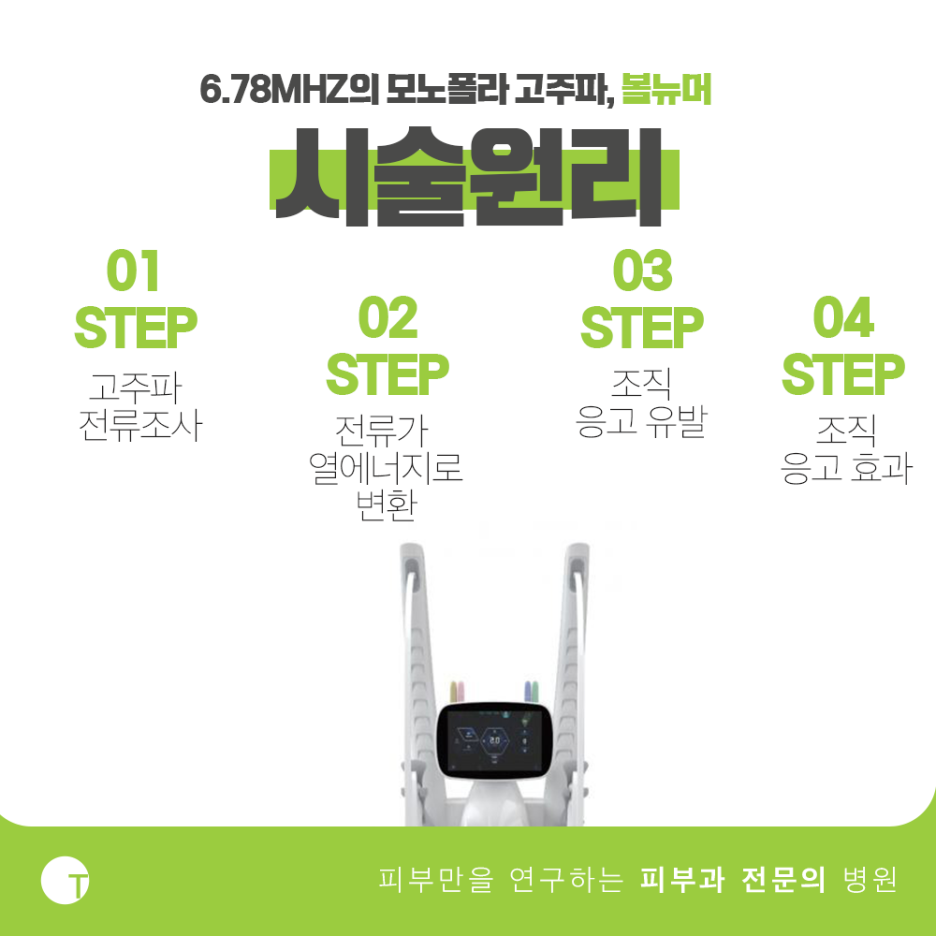역삼볼뉴머 리프팅이 필요하다면 관련 이미지 2