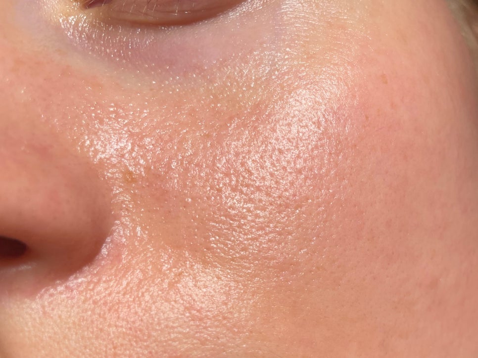 Gangnam Yeoksam Dermotoxin: If You Want to Manage Skin Texture and Pores Together image 4