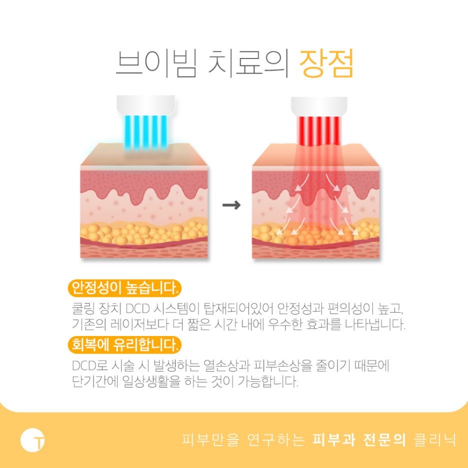 딸기코 치료 브이빔으로 환하게 관련 이미지 4