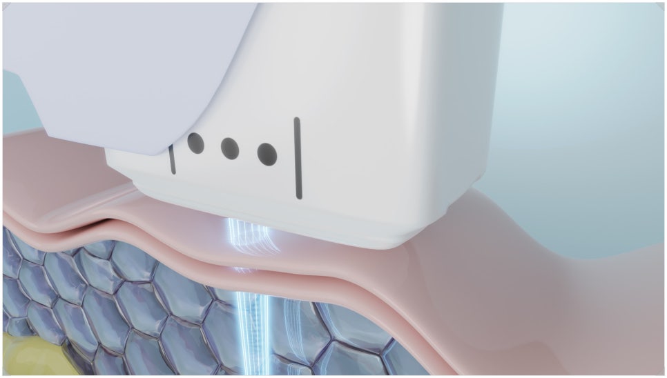 Why a Skin-Condition-Based Approach Matters at a Gangnam Yeoksam Dermatology Clinic image 2