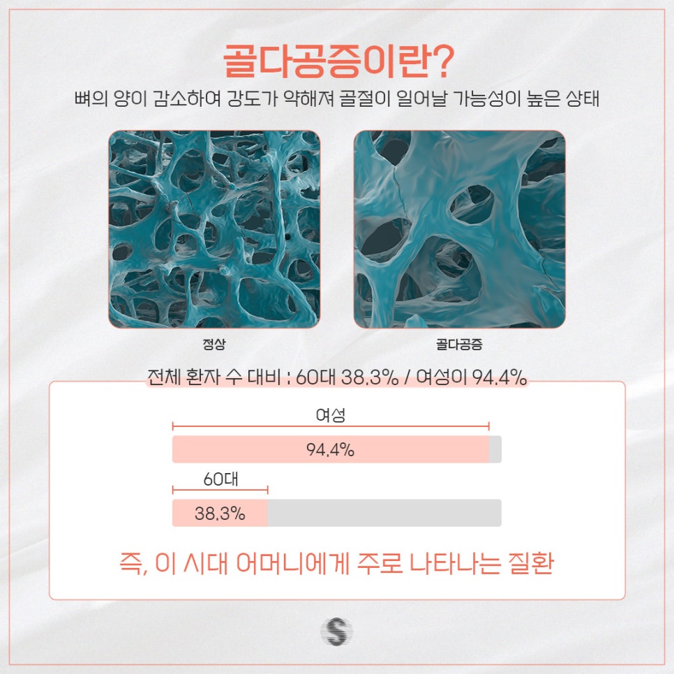골다공증 증상 및 원인 그리고 임플란트 (골다공증임플란트 PRF임플란트) 관련 이미지 2