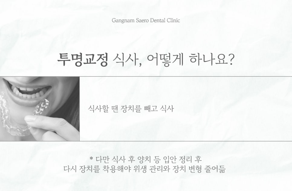 Clear Aligner Cost, Clear Aligner Pain, Clear Aligner Speech, and Eating with Clear Aligners (Q&A Collection) image 8