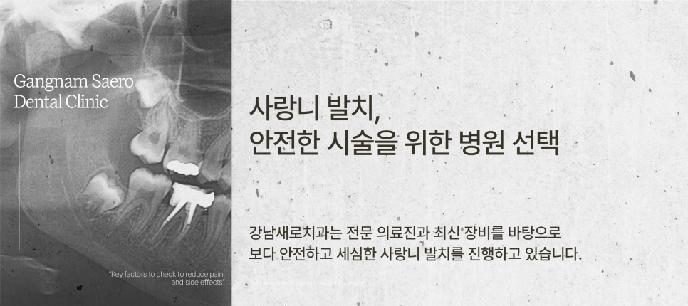 (사랑니발치) 통증과 부작용을 줄이기 위해 확인해야 할 것들 관련 이미지 5