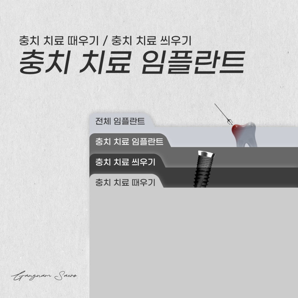 충치 치료 방법 때우기 씌우기 임플란트 (충치치료임플란트) 관련 이미지 1