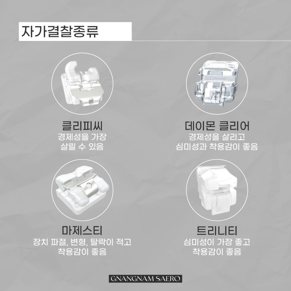클리피씨가 뭔가요? 데이몬 클리어는 뭔가요? (자가결찰교정종류) 관련 이미지 7