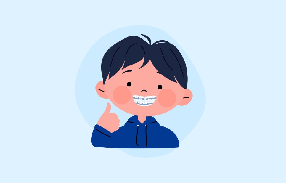 치아교정 치료 시 철사, 와이어 탈락, 구강 찔림 방지하기 관련 이미지 1