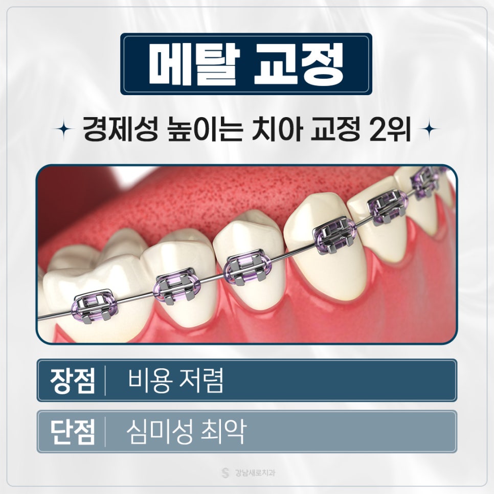 치아교정가격 교정비용비교 교정비용정리 (치아교정비용) 관련 이미지 3