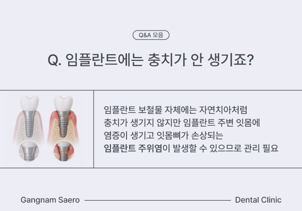 임플란트 구체적인 질문 MRI, 골다공증, 치아교정, 충치 Q&A 모음 관련 이미지 5