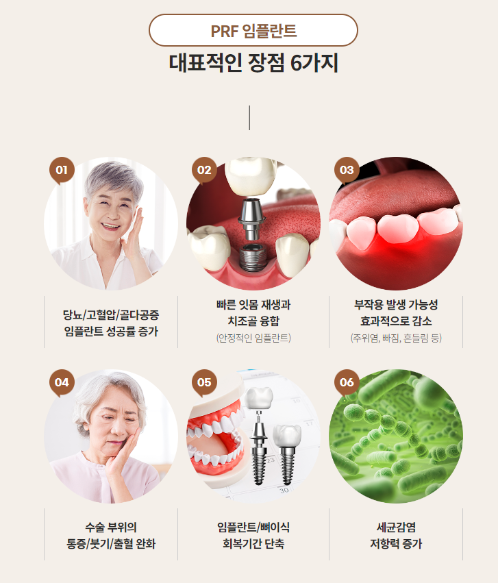 당뇨, 고혈압, 골다공증 환자에게 강남새로치과 의 선택 (PRF임플란트 자가혈임플란트) 관련 이미지 3