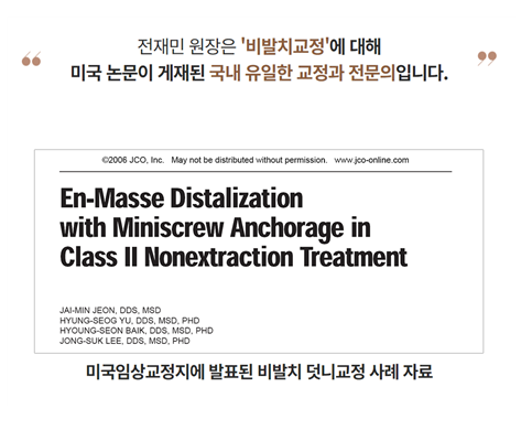 교정 전 발치 필수인가요? (비발치 중심 치아 교정) 관련 이미지 7
