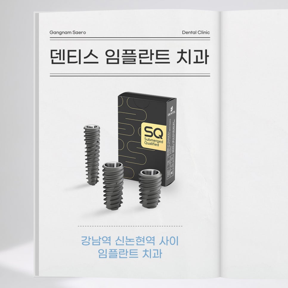 임플란트 종류 다시 알아보기 (3) 덴티스 관련 이미지 3