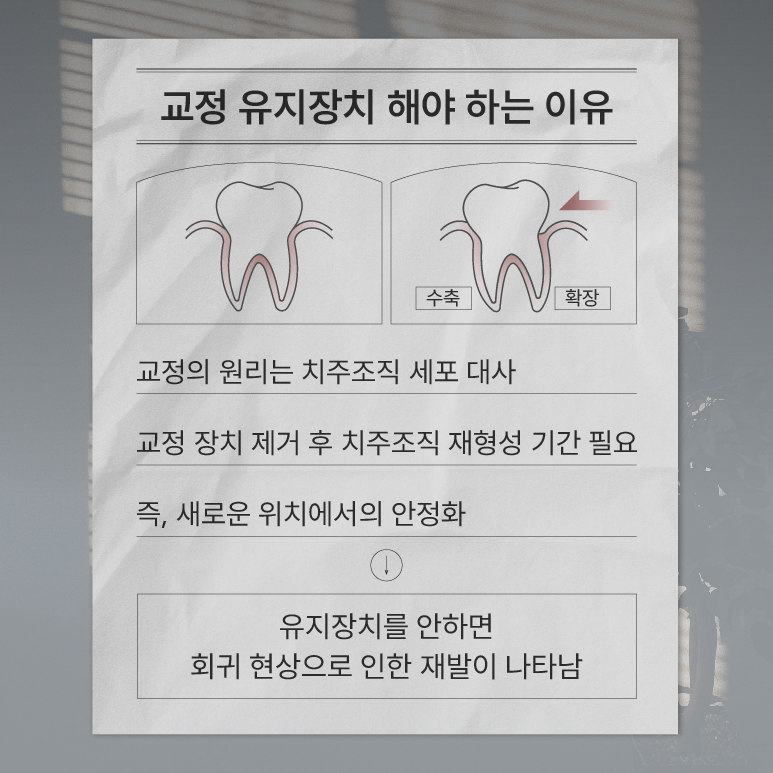 치아교정 종료 후 교정유지기 꼭 해야 하나요? (교정유지기) 관련 이미지 2