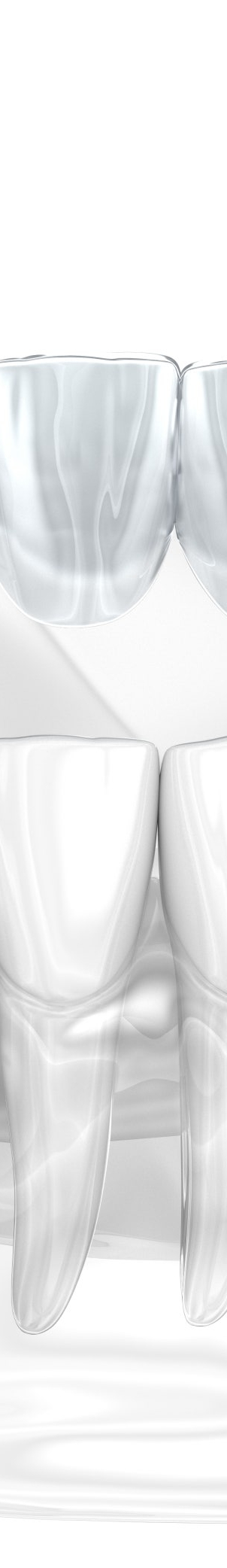 투명 교정 찾고 계신가요? 교정 치료 받기 전 같이 알아보고 갈까요? 관련 이미지 16