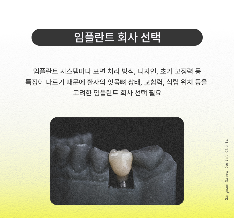 Implant Lifespan: Aren’t Implants Meant to Last a Lifetime? How to Use Them Longer image 4
