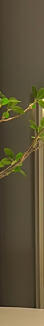 라미네이트재부착 가능할까? 보철물 파절 원인 및 대처 방법 관련 이미지 16