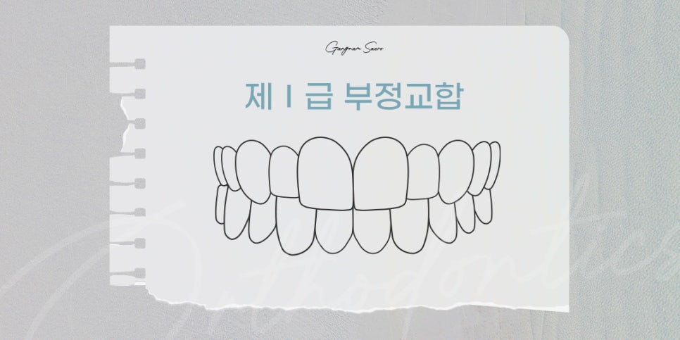 비수술 부정교합을 위한 치과 교정 (투명교정부정교합) 관련 이미지 4